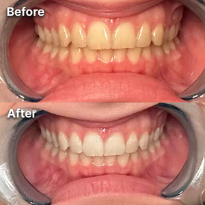 Caeloria Teeth Whitening Powder™ - Image 3
